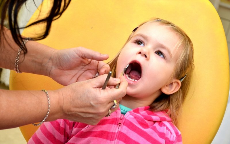 Mliječni zubi kod djece