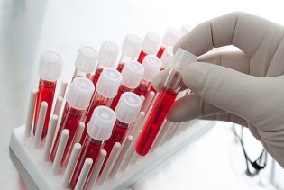 Novi test krvi u borbi protiv raka