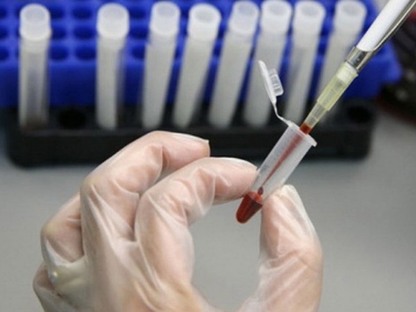 Novi testovi krvi moći će otkriti rak godinama prije nastanka bolesti