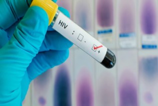 Ljudi najviše umiru od tuberkuloze i AIDS-a