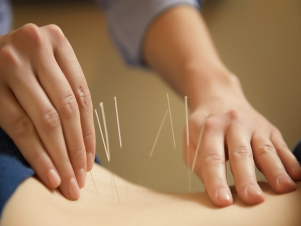 Akupunkturom protiv bolova