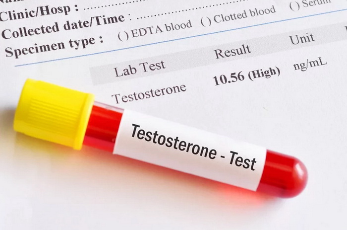 Visoka koncentracija testosterona u krvi može negativno utjecati na zdravlje srca