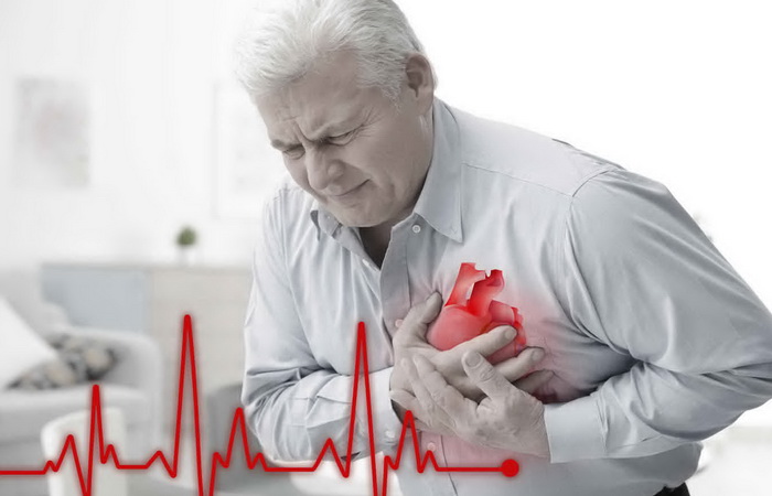 Simptomi koji upozoravaju vaše tijelo na infarkt mjesec dana ranije