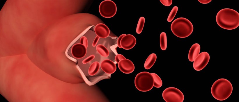 Danas se obilježava Svjetski dan hemofilije