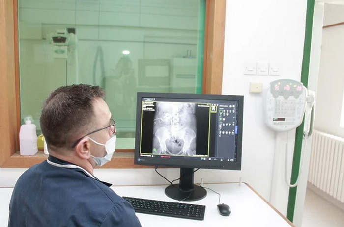Na KCUS-u instaliran novi savremeni RTG aparat, prvi nakon više od 20 godina