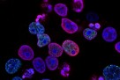Ćelije raka posjeduju značajan potencijal za evoluciju