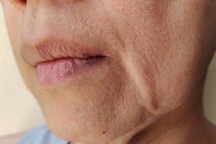 Osam znakova u ustima koji mogu biti simptomi dijabetesa