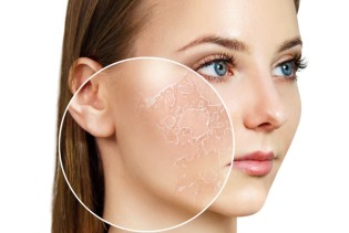 Njega suhe kože: Prirodni načini za hidrataciju i obnavljanje kože