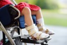 Razumijevanje cerebralne paralize: Uzroci, simptomi i poboljšanje kvalitete života