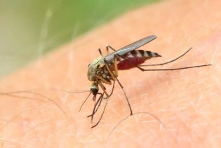 Nanesite ove prirodne sastojke za ublažavanje svrbeža od uboda komarca