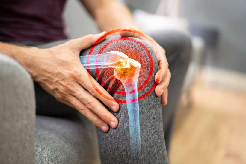 Zaboravite skupe kreme: Đumbir možda ima rješenje za artritis