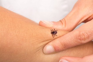 Ugriz krpelja nije bezazlen: Nova otkrića mijenjaju pristup liječenju lajmske bolesti