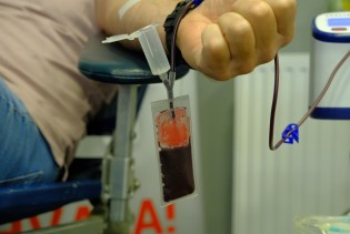 Naučnici istražuju može li ova metoda zaista usporiti starenje