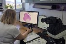 KCUS uvodi napredne AI alate za analizu uzoraka i personaliziranu terapiju