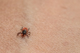 Ako ovo primijetite na koži, vjerovatno je krpelj