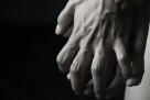 Raynaudova bolest može vas iznenaditi i tokom ljeta