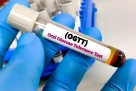 Jednostavan test u ranoj trudnoći može otkriti rizik od dijabetesa kod trudnica