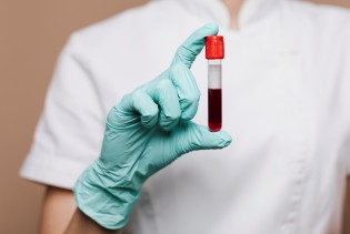 Nauka na pragu čuda: Novi test otkriva rak prije simptoma!?