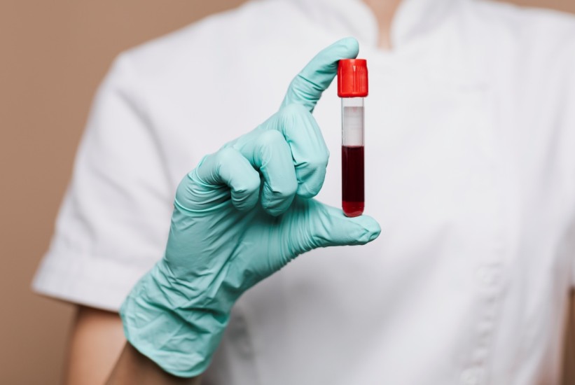 Nauka na pragu čuda: Novi test otkriva rak prije simptoma!?