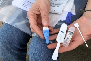 Evropa ne čini dovoljno na ranom otkrivanju HIV-a i hepatitisa