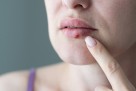 Koliko traje herpes i kada konačno niste opasni za druge?
