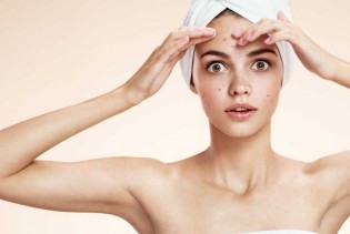 Navika ili poremećaj: Kada diranje kože postaje ozbiljan problem