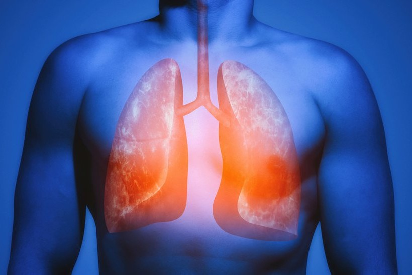 Nije bezazleno kako se mislilo: Vejping povezan s ozbiljnim rizikom od raka