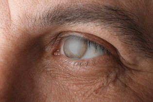 Može li morski virus ugroziti vid? Novo istraživanje otvara ozbiljna pitanja