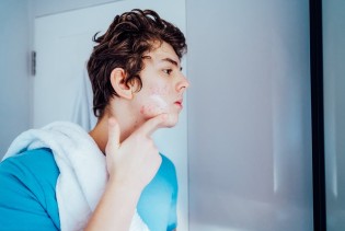 Tinejdžeri često prave ovu grešku s aknama, dermatolozi savjetuju oprez