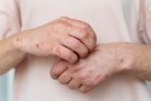 Bolest koju doktori često ne prepoznaju: Simptomi liče na deset drugih oboljenja
