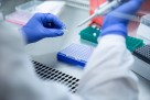 Novi test mogao bi poštedjeti milione pacijentica hemoterapije