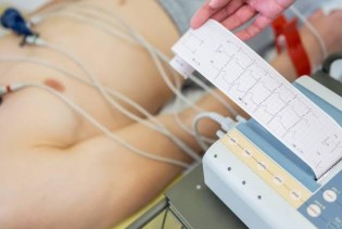 EKG pregled: Šta otkriva i kako se pravilno pripremiti?