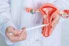 Nova nada za žene s uznapredovalim karcinomom endometrijuma: Inovativne terapije mijenjaju prognozu