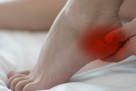 Boli vas peta pri prvim jutarnjim koracima? Možda je riječ o plantarnom fascitisu