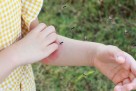 Evo kako najbolje zaštititi djecu od komaraca ovog ljeta