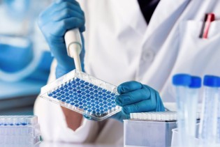 Geni nisu sudbina: Koliko genetika utiče na karcinom?
