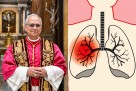 Od kakvog karcinoma boluje papa Lav? Ovo su simptomi, uzroci ...