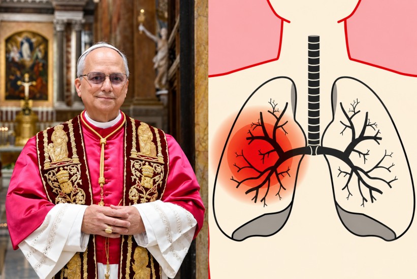 Od kakvog karcinoma boluje papa Lav? Ovo su simptomi, uzroci ...