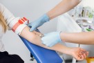 Rak sve češći među mlađima od 50 godina: Stručnjaci upozoravaju na pet faktora rizika