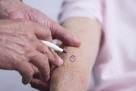 Personalizirana mRNA vakcina smanjuje rizik od povratka melanoma za 42 posto