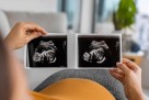 Urođene mane nisu samo pitanje zdravlja majke: Istraživanje otkriva moguću ulogu oca
